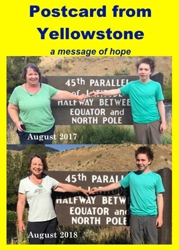 Yellowstone "Before" and "after" photos of Amanda Rose her son in August of 2017 and 2018 -- a "message of hope"
