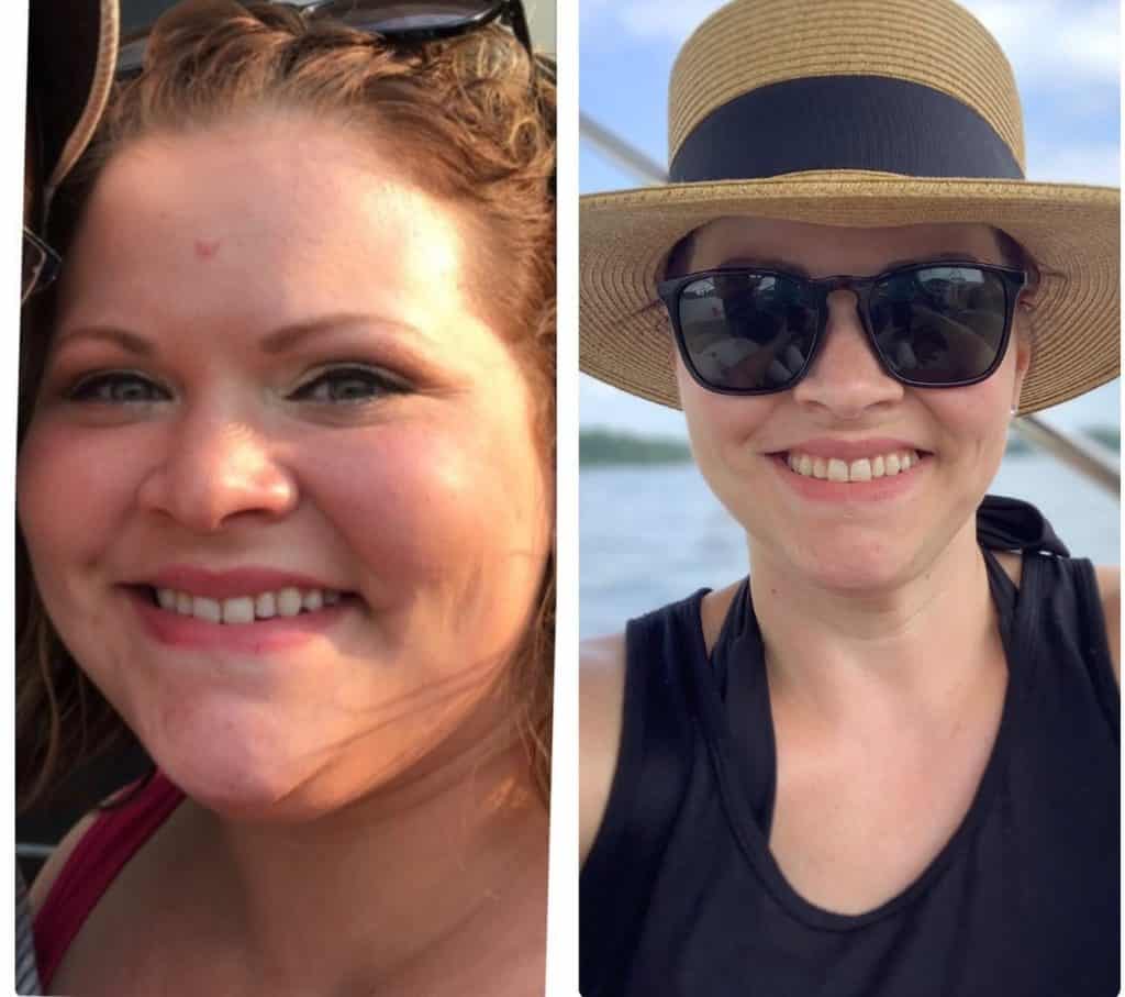 Angie, weight loss before and after of face