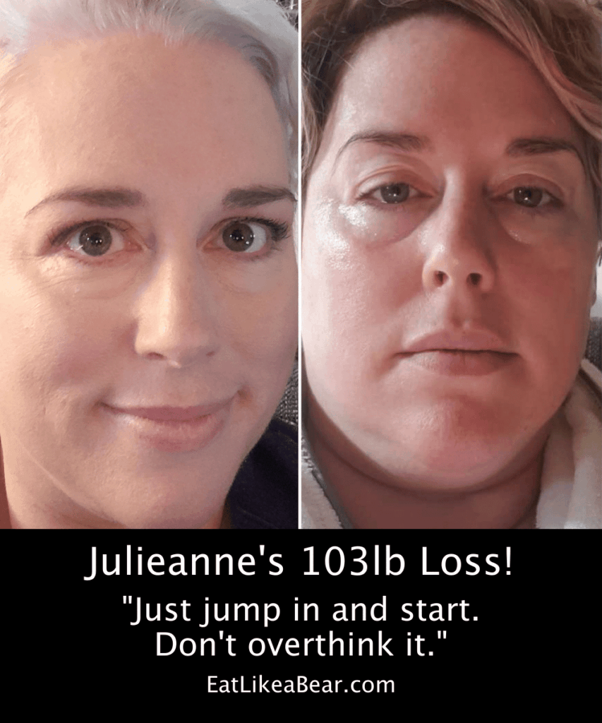 Julie's Gastric Sleeve Story, Success Stories