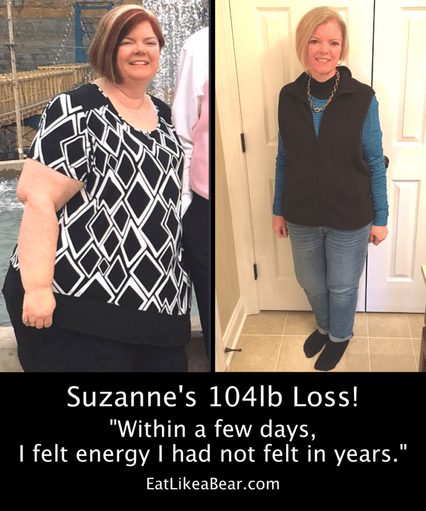 Photo of Suzanne before and after 104 pound weight loss
